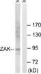 Mitogen-Activated Protein Kinase Kinase Kinase 20 antibody, TA315502, Origene, Western Blot image 