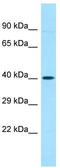 Olfactory Receptor Family 52 Subfamily A Member 5 antibody, TA332303, Origene, Western Blot image 