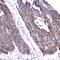Fatty Acid Binding Protein 3 antibody, A01734-1, Boster Biological Technology, Immunohistochemistry frozen image 