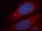 Phosphoinositide-3-Kinase Regulatory Subunit 5 antibody, 13329-1-AP, Proteintech Group, Immunofluorescence image 