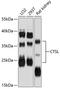 Cathepsin L antibody, 14-312, ProSci, Western Blot image 