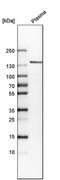 Collagen Type XIV Alpha 1 Chain antibody, PA5-54886, Invitrogen Antibodies, Western Blot image 