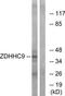 Zinc Finger DHHC-Type Containing 9 antibody, TA315447, Origene, Western Blot image 
