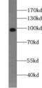 Vav Guanine Nucleotide Exchange Factor 1 antibody, FNab09377, FineTest, Western Blot image 