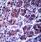 Coiled-coil domain-containing protein 22 antibody, LS-C168411, Lifespan Biosciences, Immunohistochemistry paraffin image 