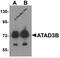 ATPase Family AAA Domain Containing 3B antibody, 6389, ProSci, Western Blot image 