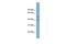 Beta-1,4-Galactosyltransferase 2 antibody, GTX46701, GeneTex, Western Blot image 