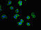 Cysteinyl Leukotriene Receptor 1 antibody, A62370-100, Epigentek, Immunofluorescence image 