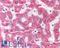 Ectonucleotide Pyrophosphatase/Phosphodiesterase 3 antibody, LS-A9842, Lifespan Biosciences, Immunohistochemistry paraffin image 