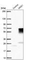 Meiosis Specific Nuclear Structural 1 antibody, PA5-59155, Invitrogen Antibodies, Western Blot image 