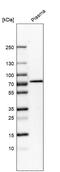 Protein S antibody, HPA023974, Atlas Antibodies, Western Blot image 