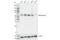 Malic enzyme 2 antibody, 15506S, Cell Signaling Technology, Western Blot image 