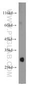 Apolipoprotein F antibody, 16608-1-AP, Proteintech Group, Western Blot image 