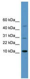 High mobility group protein HMG-I/HMG-Y antibody, TA335852, Origene, Western Blot image 