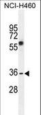 V-Set And Transmembrane Domain Containing 4 antibody, LS-C156921, Lifespan Biosciences, Western Blot image 
