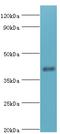SH3 Domain Containing GRB2 Like, Endophilin B1 antibody, MBS1499118, MyBioSource, Western Blot image 