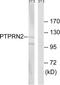Phogrin antibody, TA314409, Origene, Western Blot image 