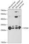 STOM antibody, GTX54719, GeneTex, Western Blot image 