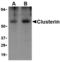 Clusterin antibody, A00590, Boster Biological Technology, Western Blot image 