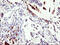 SDHL antibody, M02273, Boster Biological Technology, Immunohistochemistry paraffin image 