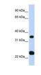 Solute Carrier Family 25 Member 35 antibody, NBP1-59606, Novus Biologicals, Western Blot image 