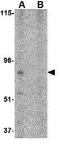 BRISC And BRCA1 A Complex Member 2 antibody, GTX31764, GeneTex, Western Blot image 