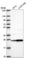 1-Acylglycerol-3-Phosphate O-Acyltransferase 1 antibody, NBP2-57898, Novus Biologicals, Western Blot image 