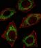 Aldehyde dehydrogenase, mitochondrial antibody, orb88884, Biorbyt, Immunocytochemistry image 