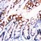 Fatty Acid Binding Protein 5 antibody, orb11655, Biorbyt, Immunohistochemistry paraffin image 
