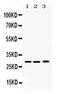 Proteasome subunit alpha type-3 antibody, PA5-79890, Invitrogen Antibodies, Western Blot image 