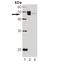 Neutrophil Cytosolic Factor 1 antibody, A01586, Boster Biological Technology, Western Blot image 