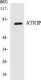 ATR Interacting Protein antibody, EKC1047, Boster Biological Technology, Western Blot image 