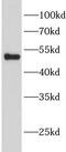 Glutathione Synthetase antibody, FNab10267, FineTest, Western Blot image 