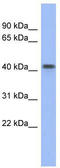 FLT3 Interacting Zinc Finger 1 antibody, TA329641, Origene, Western Blot image 