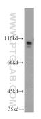 Ubiquitin carboxyl-terminal hydrolase 33 antibody, 20445-1-AP, Proteintech Group, Western Blot image 