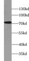 Ubiquitin Interaction Motif Containing 1 antibody, FNab09247, FineTest, Western Blot image 