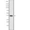 Lactate Dehydrogenase A Like 6A antibody, abx149988, Abbexa, Western Blot image 
