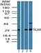 TP53 Induced Glycolysis Regulatory Phosphatase antibody, PA1-41382, Invitrogen Antibodies, Western Blot image 