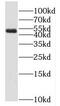Malonyl-CoA decarboxylase, mitochondrial antibody, FNab05225, FineTest, Western Blot image 
