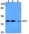 Carcinoembryonic Antigen Related Cell Adhesion Molecule 8 antibody, A05978, Boster Biological Technology, Western Blot image 