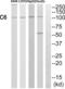 Complement C6 antibody, abx014386, Abbexa, Western Blot image 