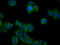 Cyclin And CBS Domain Divalent Metal Cation Transport Mediator 2 antibody, LS-C680300, Lifespan Biosciences, Immunofluorescence image 