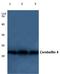 Cerebellin 4 Precursor antibody, A13373, Boster Biological Technology, Western Blot image 