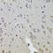 Integrin Subunit Beta 8 antibody, 23-580, ProSci, Immunohistochemistry paraffin image 