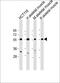 Tripartite Motif Containing 72 antibody, 56-156, ProSci, Western Blot image 