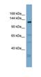 Anoctamin-3 antibody, orb325534, Biorbyt, Western Blot image 