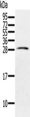 Paired Immunoglobin Like Type 2 Receptor Beta antibody, TA350284, Origene, Western Blot image 