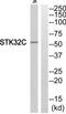 Serine/Threonine Kinase 32C antibody, TA316296, Origene, Western Blot image 