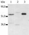 CD4 antibody, SM3019P, Origene, Western Blot image 