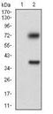 Tubulin Epsilon 1 antibody, NBP2-37244, Novus Biologicals, Western Blot image 